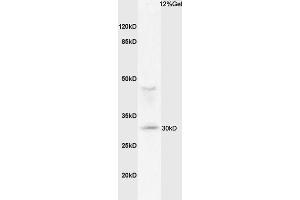 Mouse lung lysates probed with Anti MHC Class II Polyclonal Antibody, Unconjugated (ABIN1713842) at 1:200 overnight at 4 °C. (MHC Class II Antikörper  (AA 111-200))