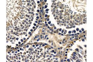 ABIN7096802 and ABIN7100868 at 1/100 staining rat testis tissue by IHC-P. (TSKS Antikörper)