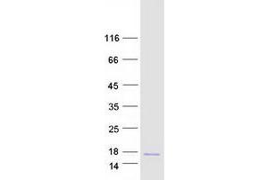 Western Blotting (WB) image for Defensin, alpha 1 (DEFA1) protein (Myc-DYKDDDDK Tag) (ABIN2719348)