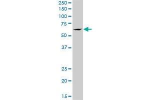 Western Blotting (WB) image for anti-Transforming Growth Factor beta Regulator 4 (TBRG4) (AA 1-631) antibody (ABIN522700)