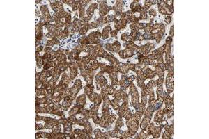 Immunohistochemical staining (Formalin-fixed paraffin-embedded sections) of human liver with ACAT1 polyclonal antibody  shows strong cytoplasmic positivity in hepatocytes. (ACAT1 Antikörper)