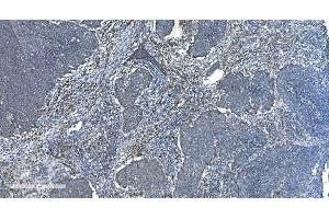 IHC analysis of TIMM8A/DDP using anti-TIMM8A/DDP antibody (ABIN7600039). (TIMM8A/DDP Antikörper  (AA 14-97))