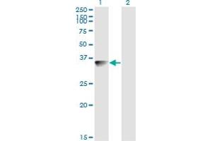 Western Blot analysis of BLVRA expression in transfected 293T cell line by BLVRA monoclonal antibody (M03), clone S2. (Biliverdin Reductase Antikörper  (AA 1-296))
