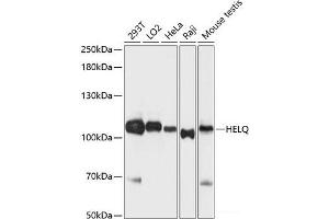 Western blot analysis of extracts of various cell lines using HEL308 Polyclonal Antibody at dilution of 1:3000. (HEL308 Antikörper)
