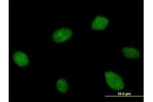 Immunofluorescence of purified MaxPab antibody to KIAA1604 on HeLa cell.