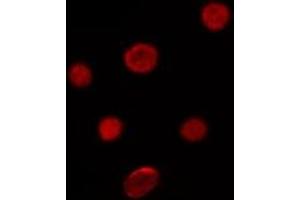 ABIN6276688 staining Hela by IF/ICC. (p21 Antikörper  (Internal Region))