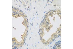 Immunohistochemistry of paraffin-embedded human prostate using ENPEP antibody (ABIN5975067) at dilution of 1/200 (40x lens). (ENPEP Antikörper)