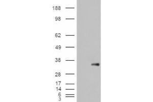 Western Blotting (WB) image for anti-WNT1 Inducible Signaling Pathway Protein 1 (WISP1) (C-Term) antibody (ABIN2466452) (WISP1 Antikörper  (C-Term))