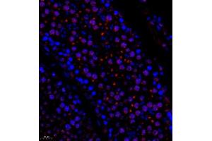 Immunofluorescence (Paraffin-embedded Sections) (IF (p)) image for anti-Suppressor of Variegation 3-9 Homolog 2 (Drosophila) (SUV39H2) antibody (ABIN7075771)