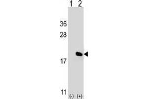Western blot analysis of IL17A (arrow) using Interleukin-17A (IL17A) Antibody ; 293 cell lysates (2 ug/lane) either nontransfected (Lane 1) or transiently transfected (Lane 2) with the IL17A gene. (Interleukin 17a Antikörper  (Middle Region))