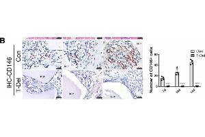 Infiltration of Cells and osteogenic differentiation MSCs around BCP dependent on T cells. (SETD7 Antikörper  (AA 1-366))