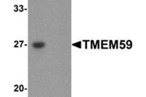 Western blot analysis of TMEM59 in human kidney tissue lysate with TMEM59 antibody at 1 μg/mL in (left) the absence and (right) the presence of blocking peptide. (TMEM59 Antikörper  (N-Term))