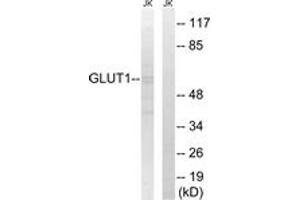 Western Blotting (WB) image for anti-Solute Carrier Family 2 (Facilitated Glucose Transporter), Member 1 (SLC2A1) (AA 441-490) antibody (ABIN2879123) (GLUT1 Antikörper  (AA 441-490))