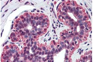 Human Breast (formalin-fixed, paraffin-embedded) stained with TP73 antibody ABIN298091 at 5 ug/ml followed by biotinylated anti-mouse IgG secondary antibody ABIN481714, alkaline phosphatase-streptavidin and chromogen. (Tumor Protein p73 Antikörper  (N-Term))