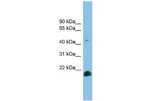 TGF beta 2 antibody used at 1 ug/ml to detect target protein. (TGFB2 Antikörper  (Middle Region))