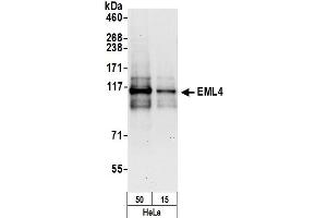 Western Blotting (WB) image for anti-Echinoderm Microtubule Associated Protein Like 4 (EML4) (AA 150-200) antibody (ABIN7454793)