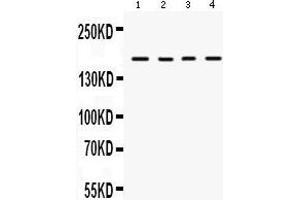 Anti-HKDC1 Picoband antibody, Western blotting All lanes: Anti HKDC1  at 0. (HKDC1 Antikörper  (N-Term))