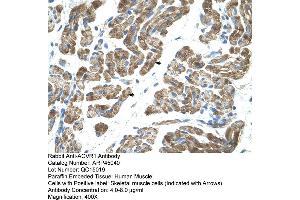 Immunohistochemistry (IHC) image for anti-Activin Receptor Type I (ACRV1) (N-Term) antibody (ABIN2782109)