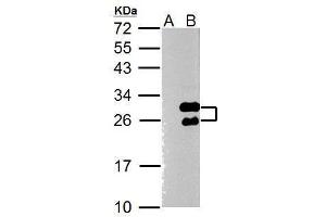 WB Image Twist1 antibody [N1C3] detects Twist1 protein by Western blot analysis. (TWIST1 Antikörper  (Center))