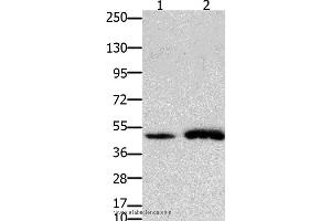 Western blot analysis of Mouse brain and  heart tissue, using FOXL2 Polyclonal Antibody at dilution of 1:750