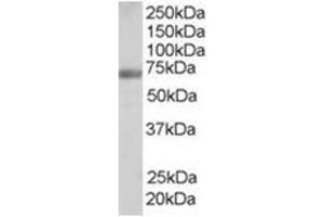 Image no. 1 for anti-Formin Binding Protein 1 (FNBP1) (Internal Region) antibody (ABIN374468)