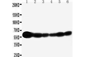 Anti-SHC antibody, Western blotting Lane 1: Rat Brain Tissue Lysate Lane 2: A549 Cell Lysate Lane 3: A431 Cell Lysate Lane 4: 293T Cell Lysate Lane 5: HELA Cell Lysate Lane 6: JURKAT Cell Lysate (SHC1 Antikörper  (C-Term))