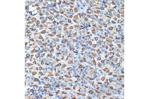 Immunohistochemistry (IHC) image for anti-ATPase, H+/K+ Exchanging, beta Polypeptide (ATP4b) antibody (ABIN7265767)