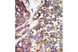 Image no. 2 for anti-P21-Activated Kinase 2 (PAK2) (N-Term) antibody (ABIN360318)