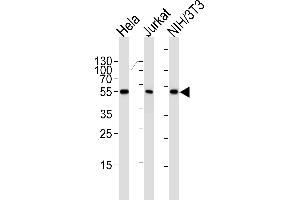 Western blot analysis of lysates from Hela, Jurkat, mouse NIH/3T3 cell line (from left to right), using ARA Antibody (ABIN1944858 and ABIN2838532).