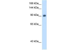 Western Blotting (WB) image for anti-Nuclear Receptor Subfamily 3, Group C, Member 2 (NR3C2) (Middle Region) antibody (ABIN2773864)