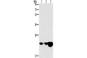 Gel: 10 % SDS-PAGE, Lysate: 40 μg, Lane 1-3: Mouse kidney tissue, Mouse liver tissue, human fetal liver tissue, Primary antibody: ABIN7191000(HRASLS2 Antibody) at dilution 1/362. (HRASLS2 Antikörper)