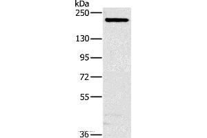 Western blot analysis of Hela cell, using NCOA3 Polyclonal Antibody at dilution of 1:200 (NCOA3 Antikörper)