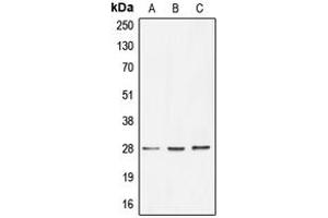 Western blot analysis of BRMS1 expression in HT29 (A), HeLa (B), MCF7 (C) whole cell lysates.