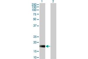 Western Blot analysis of DUSP22 expression in transfected 293T cell line by DUSP22 monoclonal antibody (M01), clone 3D3. (DUSP22 Antikörper  (AA 112-184))