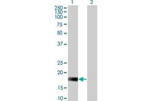 DUSP22 Antikörper  (AA 112-184)