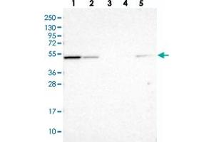 Western blot analysis of Lane 1: RT-4, Lane 2: U-251 MG, Lane 3: Human Plasma, Lane 4: Liver, Lane 5: Tonsil with NSUN7 polyclonal antibody  at 1:100-1:250 dilution.