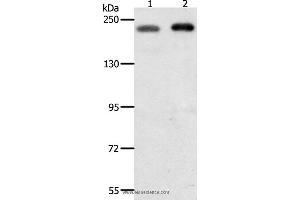 Western blot analysis of Hela and Jurkat cell, using SMARCA4 Polyclonal Antibody at dilution of 1:700 (SMARCA4 Antikörper)