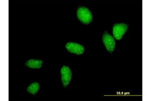 Immunofluorescence of monoclonal antibody to UBE2C on HeLa cell. (UBE2C Antikörper  (AA 1-179))