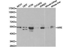 Western Blotting (WB) image for anti-Autoimmune Regulator (AIRE) antibody (ABIN1870889) (AIRE Antikörper)