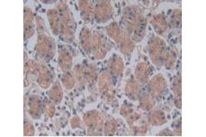 DAB staining on IHC-P; Samples: Human Stomach Tissue. (TLR5 Antikörper  (AA 693-858))
