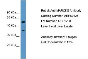 Western Blotting (WB) image for anti-Myristoylated Alanine-Rich Protein Kinase C Substrate (MARCKS) (C-Term) antibody (ABIN786131) (MARCKS Antikörper  (C-Term))