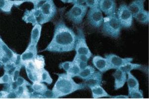 Immunofluorescent staining of ES2 cells. (STRAP Antikörper  (AA 42-154))