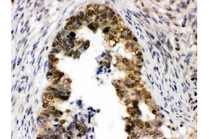IHC analysis of UHRF1 using anti-UHRF1 antibody (ABIN3044567).