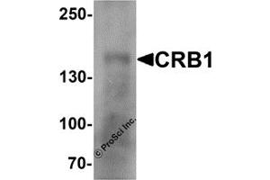 Western Blotting (WB) image for anti-Crumbs Homolog 1 (CRB1) antibody (ABIN1077415) (CRB1 Antikörper)