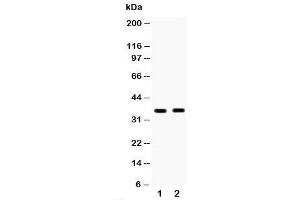 Western blot testing of HSD17B6 antibody and Lane 1:  human placenta;  2: MCF-7;  Predicted size: 35KD;  Observed size: 35KD (HSD17B6 Antikörper  (C-Term))