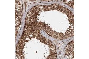 Immunohistochemical staining of human testis with FAXC polyclonal antibody  shows strong cytoplasmic positivity in cells in seminiferus ducts at 1:200-1:500 dilution. (C6orf168 Antikörper)