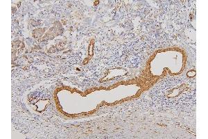 IHC analysis of RAB3GAP2 using anti-RAB3GAP2 antibody (ABIN6719633). (RAB3GAP2 Antikörper  (AA 1-115))