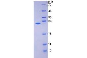 SDS-PAGE of Protein Standard from the Kit (Highly purified E. (AMBP ELISA Kit)
