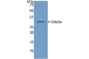 Detection of Recombinant AMY2, Human using Polyclonal Antibody to Amylase, Alpha 2A (AMY2A) (AMY2A Antikörper  (AA 188-432))