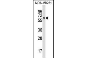 BTN3A1 Antibody (C-term) (ABIN657422 and ABIN2846459) western blot analysis in MDA-M cell line lysates (35 μg/lane). (BTN3A1 Antikörper  (C-Term))